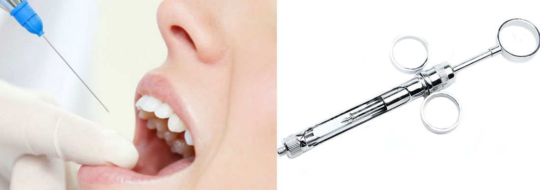 Шприцы карпульные и другие расходные материалы для стоматологии